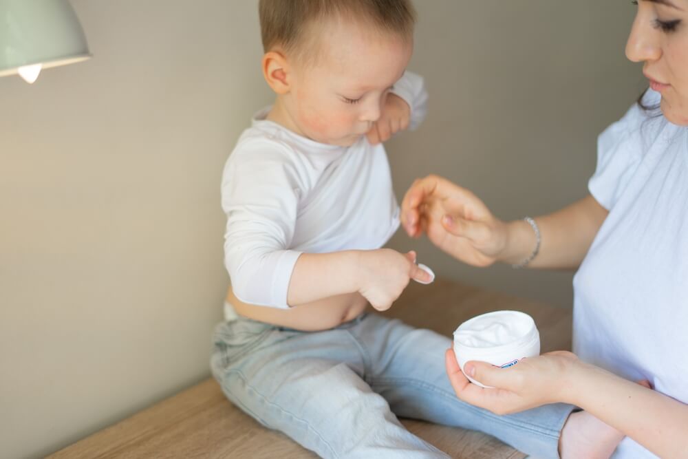 “mama i dete nanose kremu za atopijski dermatitis na telo deteta
