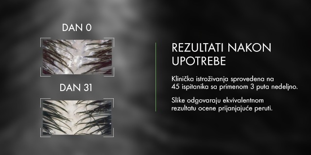 REZULTATI NAKON UPOTREBE